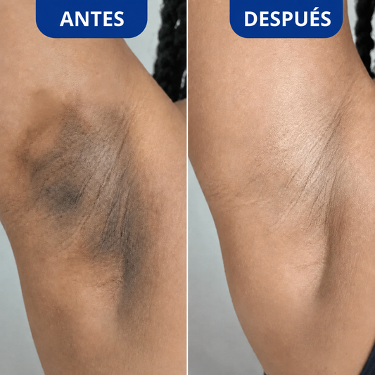 Exfoliante Corporal para Zonas Oscuras