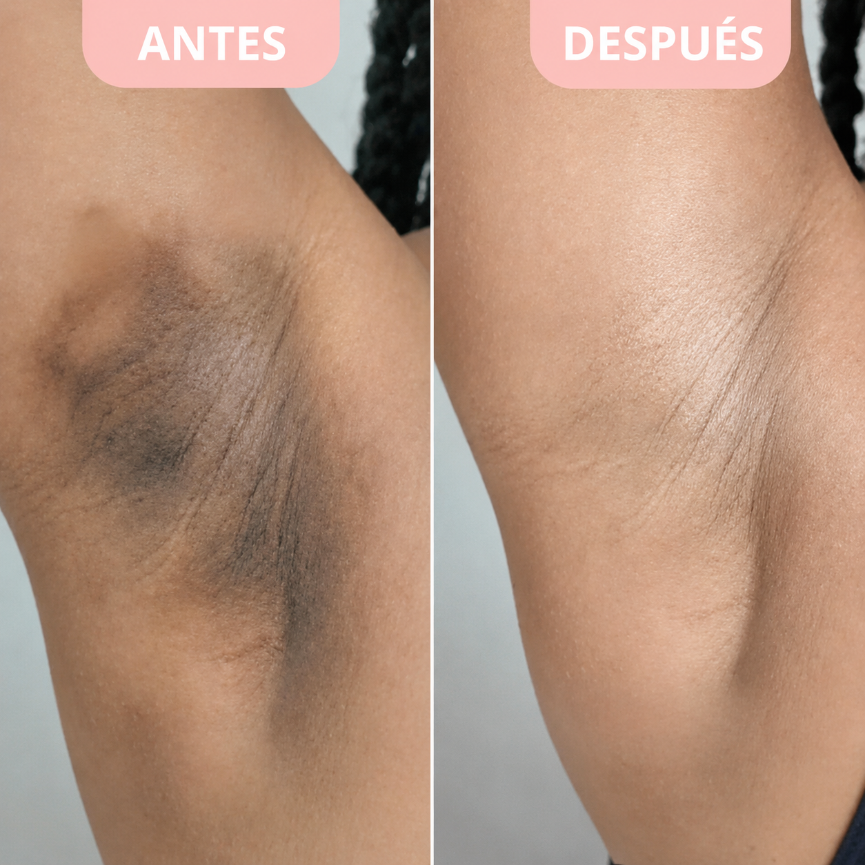 Exfoliante Corporal para Zonas Oscuras